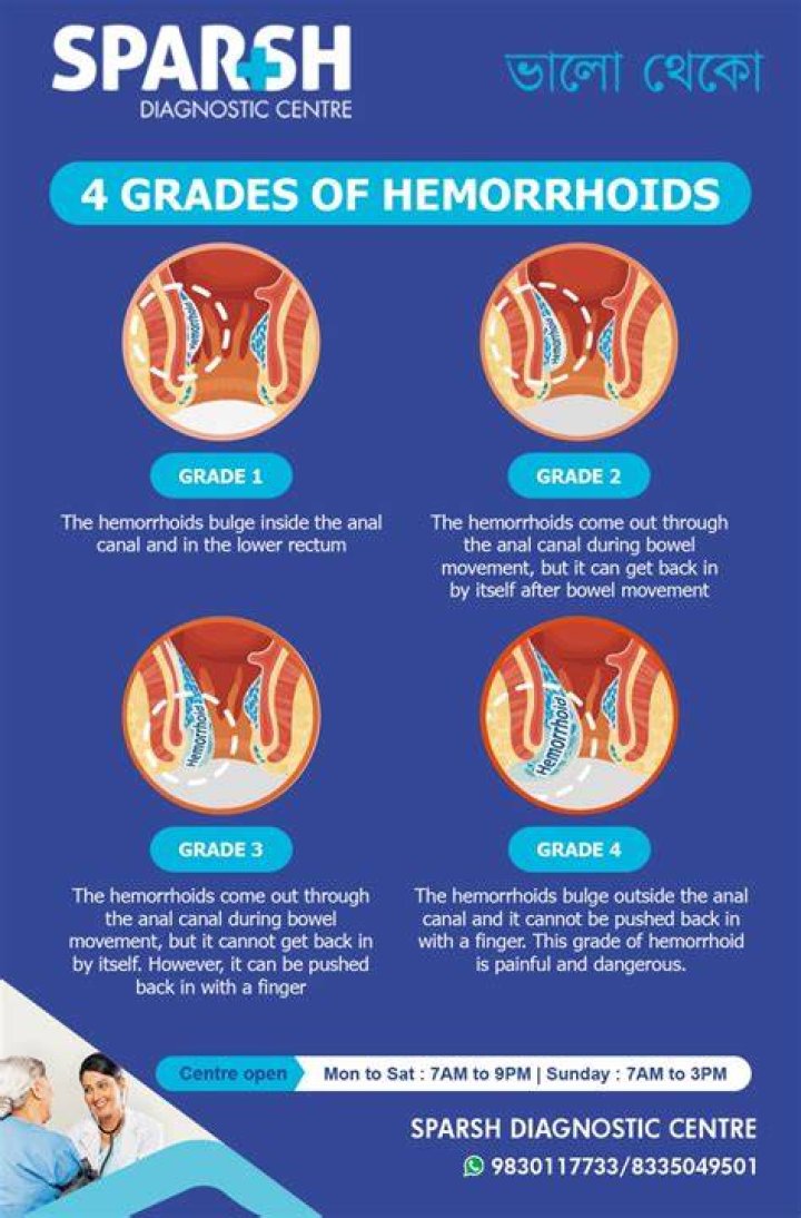 Are hemorrhoids reversible?