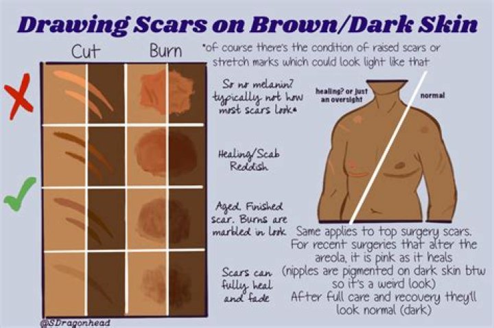Are scars lighter or darker than skin?