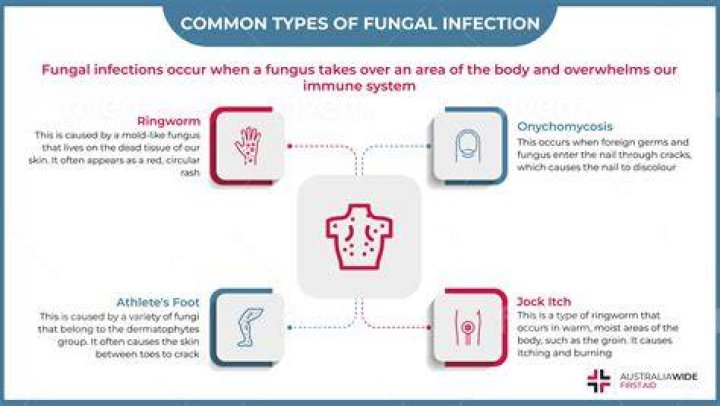 Are there different types of fungal infections?