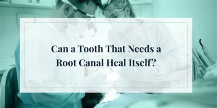 Can a tooth that needs a root canal heal itself?
