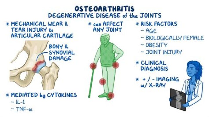Can osteoarthritis patients do walking?