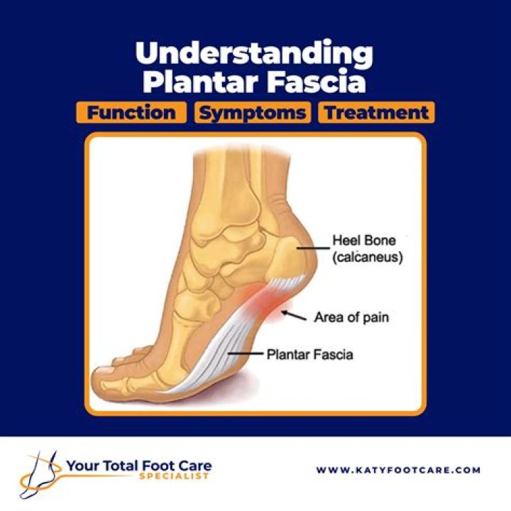Can plantar fasciitis be a permanent disability?