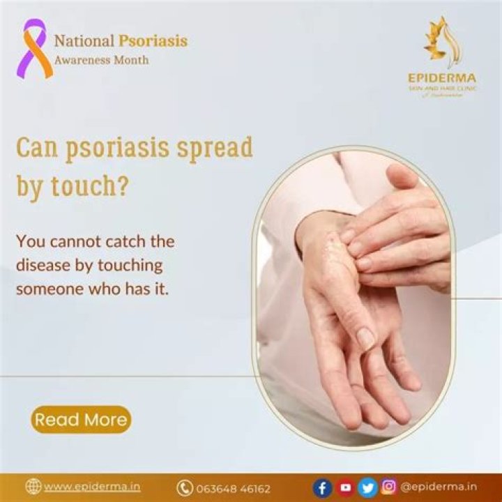 Can psoriasis spread by touch?