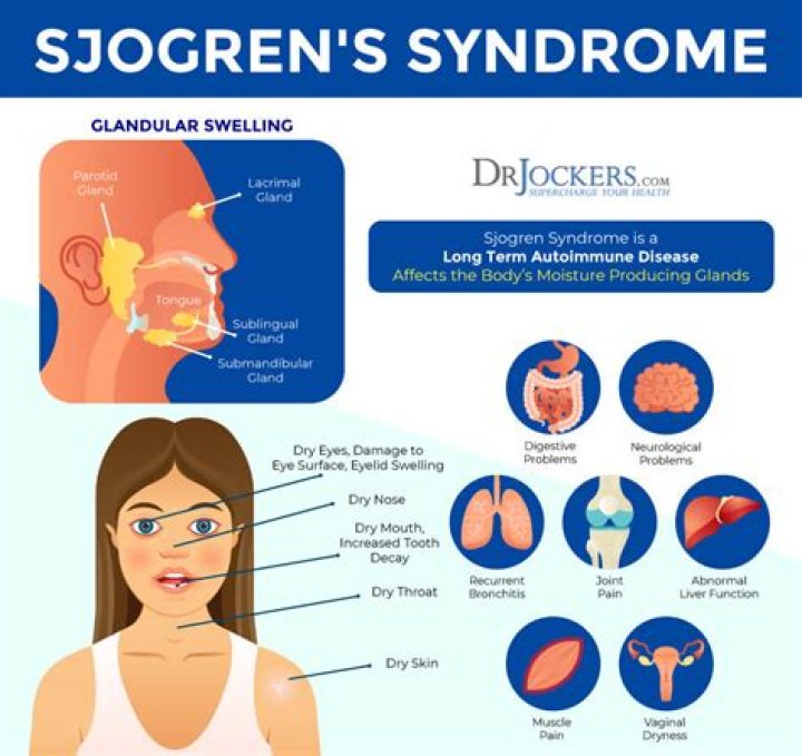 Can Sjogren's affect your heart?