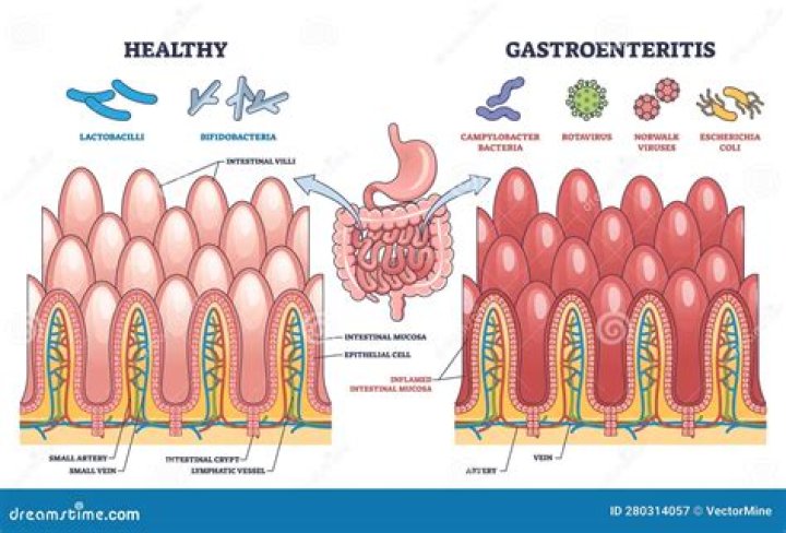 Can you get gastroenteritis twice in a month?