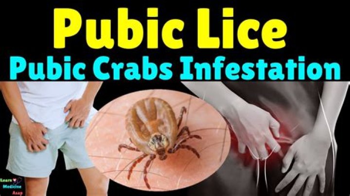 Can you get pubic lice from a toilet seat?