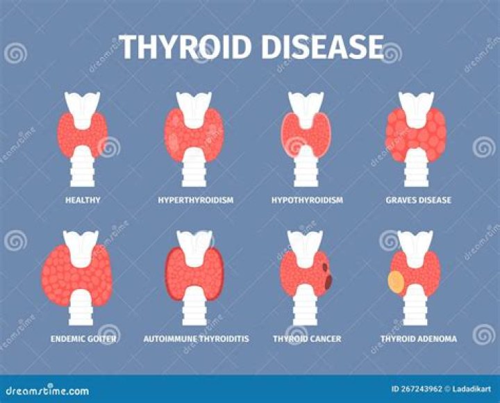 Can your thyroid affect your sinuses?