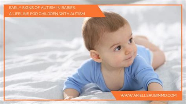 Do babies with autism smile a lot?