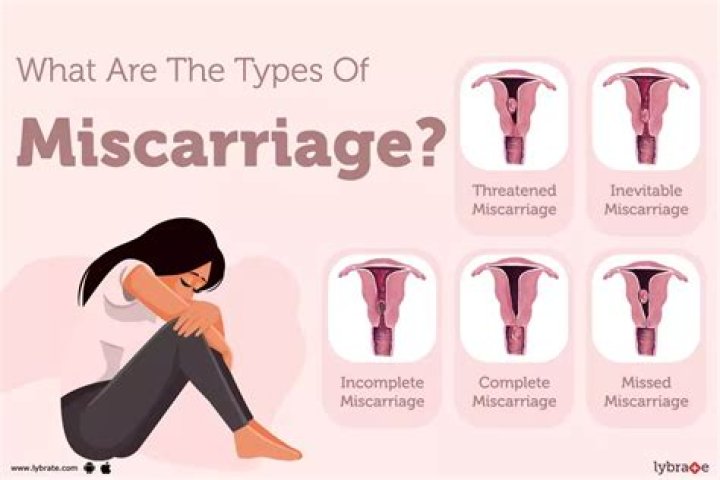 Do miscarriages have an odor?