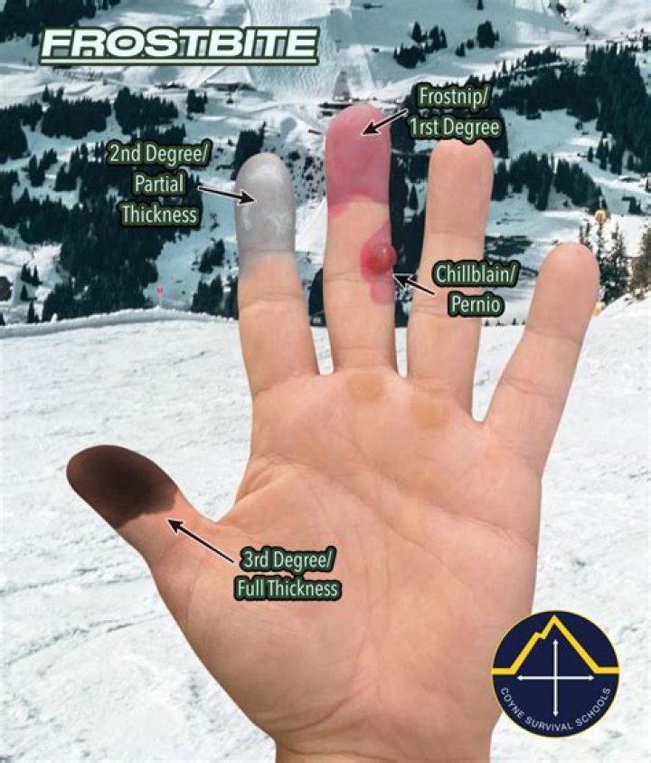 Do they get Killer Frost back?