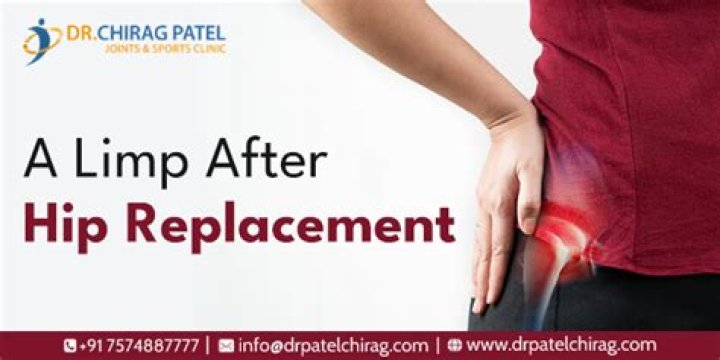 Do you walk with a limp after hip replacement?