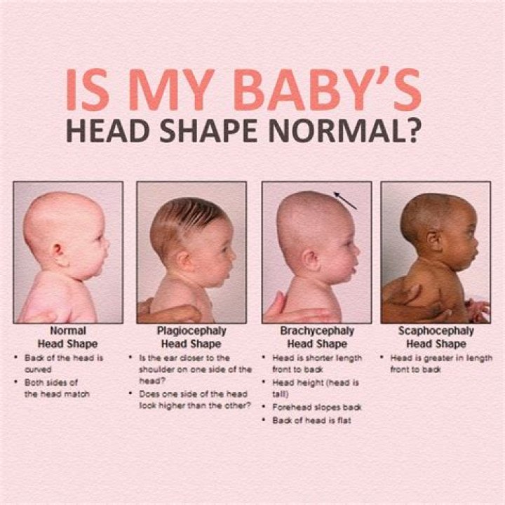 Does a baby head grow after birth?