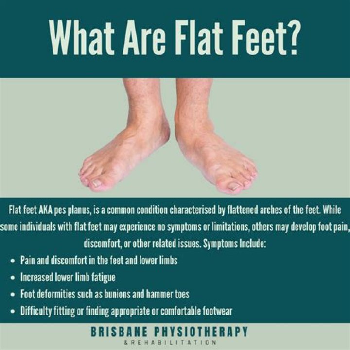 Does being flat footed affect snowboarding?