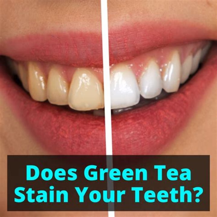 Does green tea stain teeth?