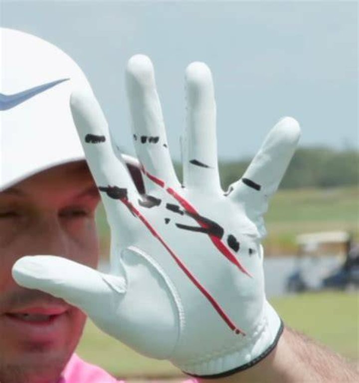 Does Tiger chip with a glove?