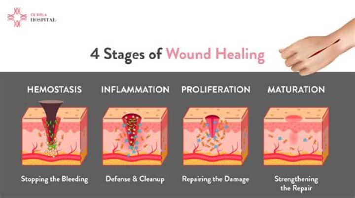 Does zinc help wounds heal faster?