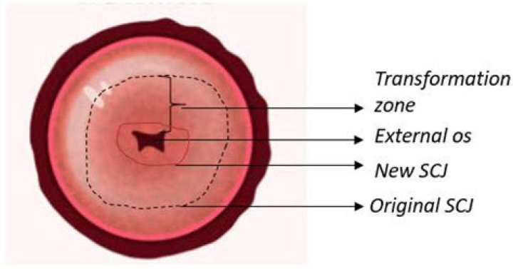 How can you tell if your cervix is thinning out?
