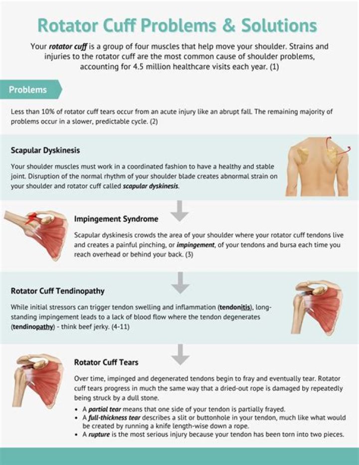 How do I know if I injured my rotator cuff?