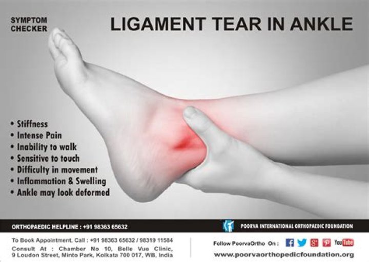 How do I know if I tore a ligament in my ankle?