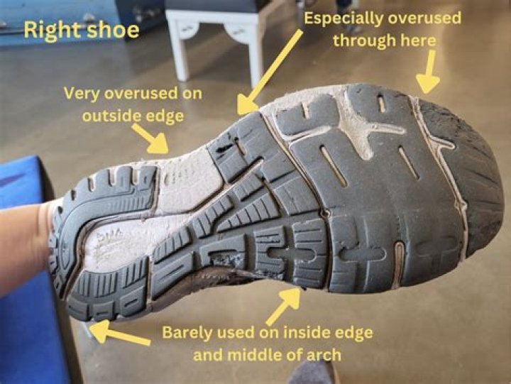 How do I stop my shoes rubbing the side of my ankle?