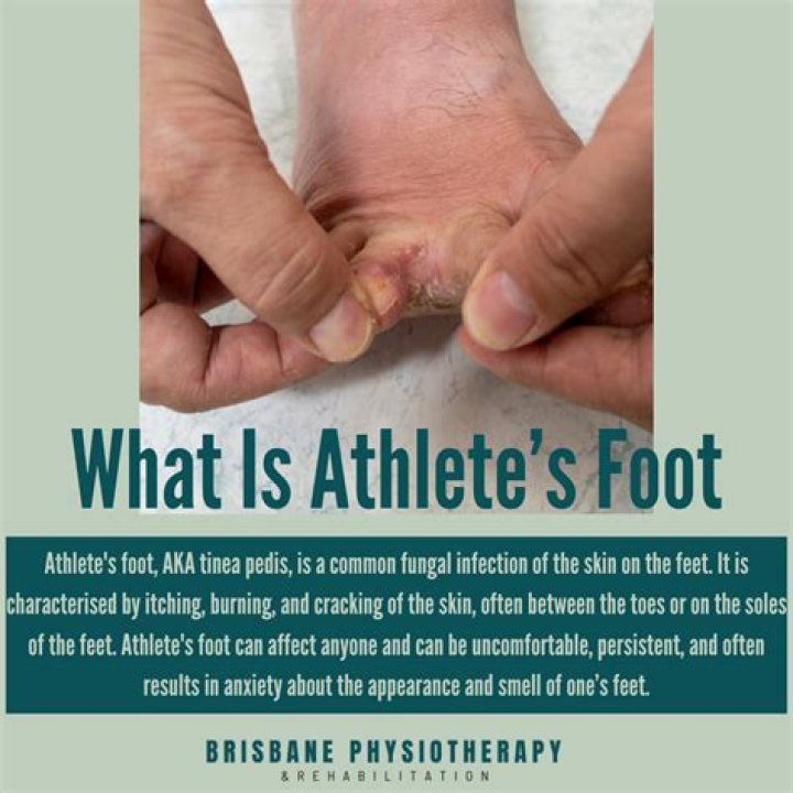 How do you disinfect a shower from athlete's foot?