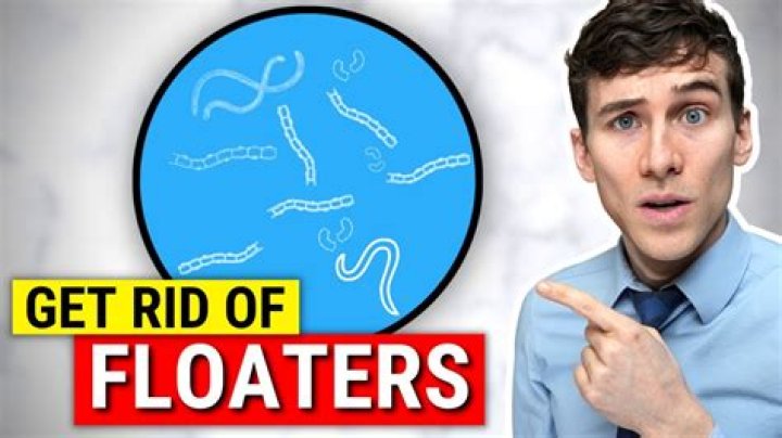 How do you permanently get rid of eye floaters?