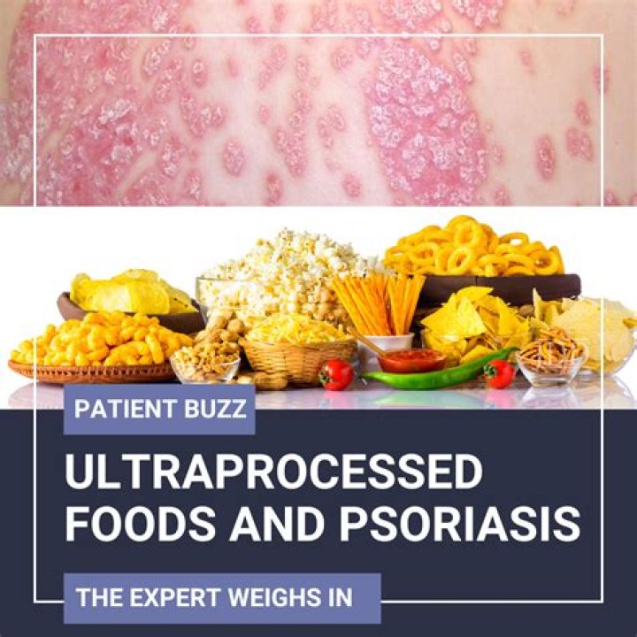How do you permanently treat psoriasis?