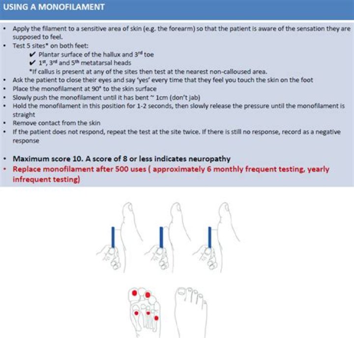 How do you test for foot neuropathy?