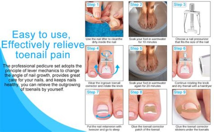 How do you treat toenail pain?