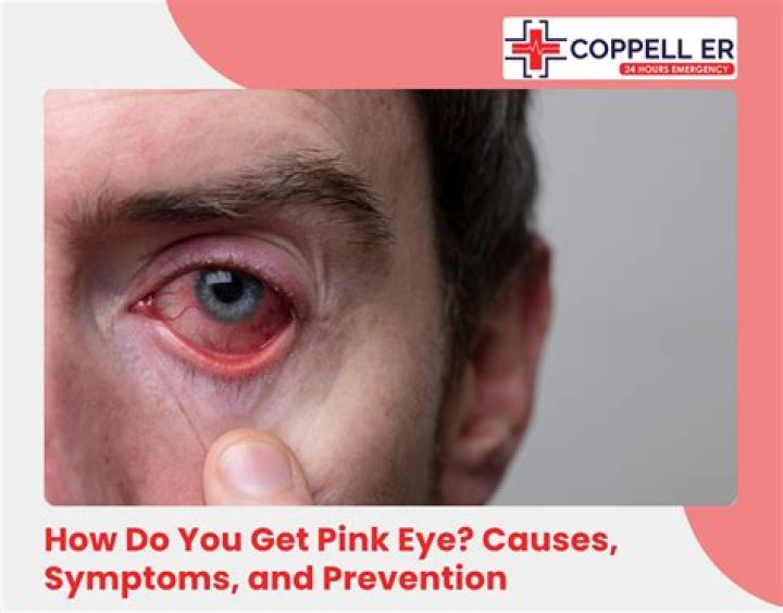 How does a monocle stay in your eye?