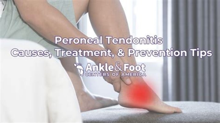 How does tendonitis feel?