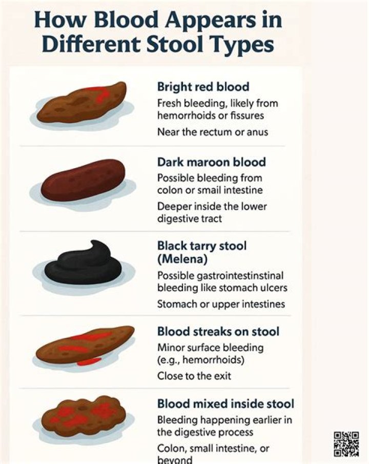 How long is bloody stool normal?