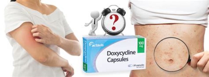 How long should I wait to eat dairy after taking doxycycline?