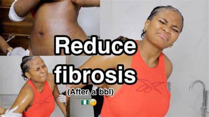 Is a BBL painful?