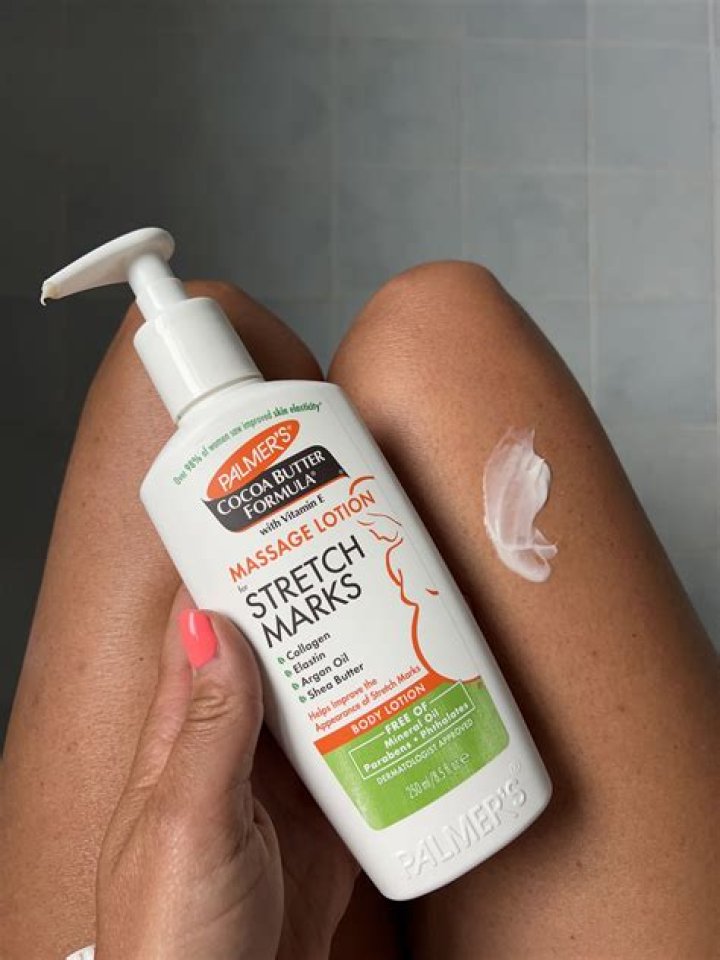 Is almond oil good for stretch marks?