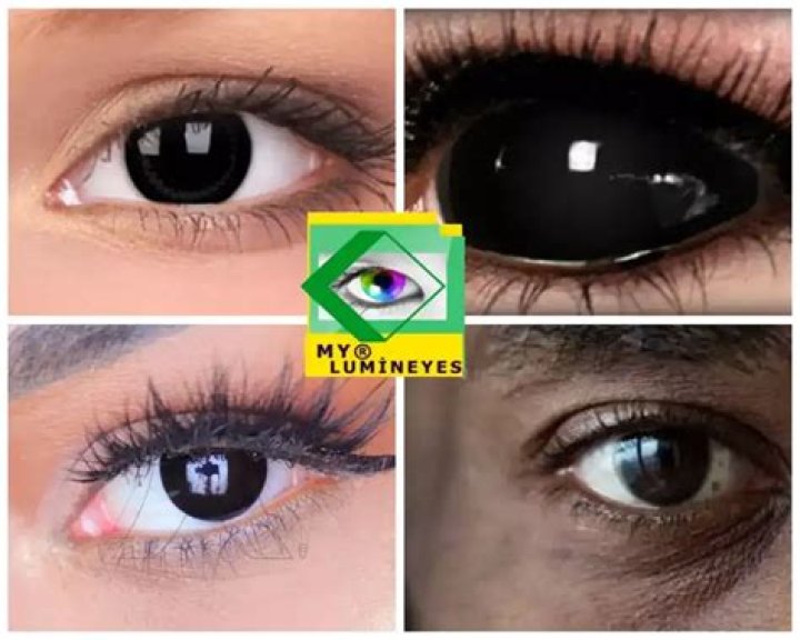 Is Black an eye color?