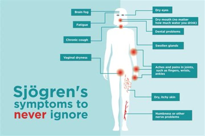 Is sjogrens a serious disease?