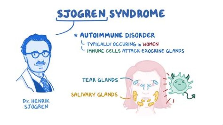 Is sjogrens fatal?