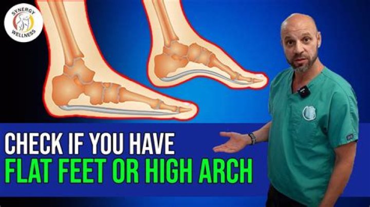 Should your feet be arched or flat?