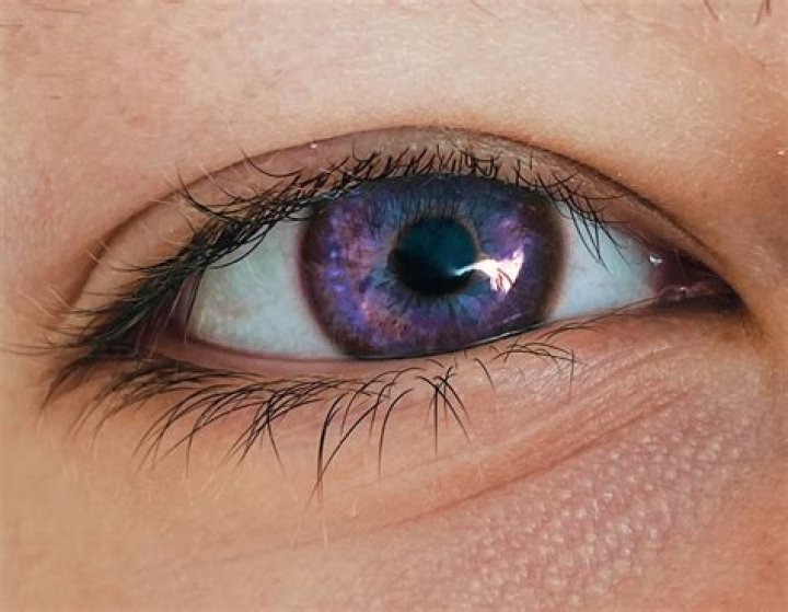 What are purple eyes called?