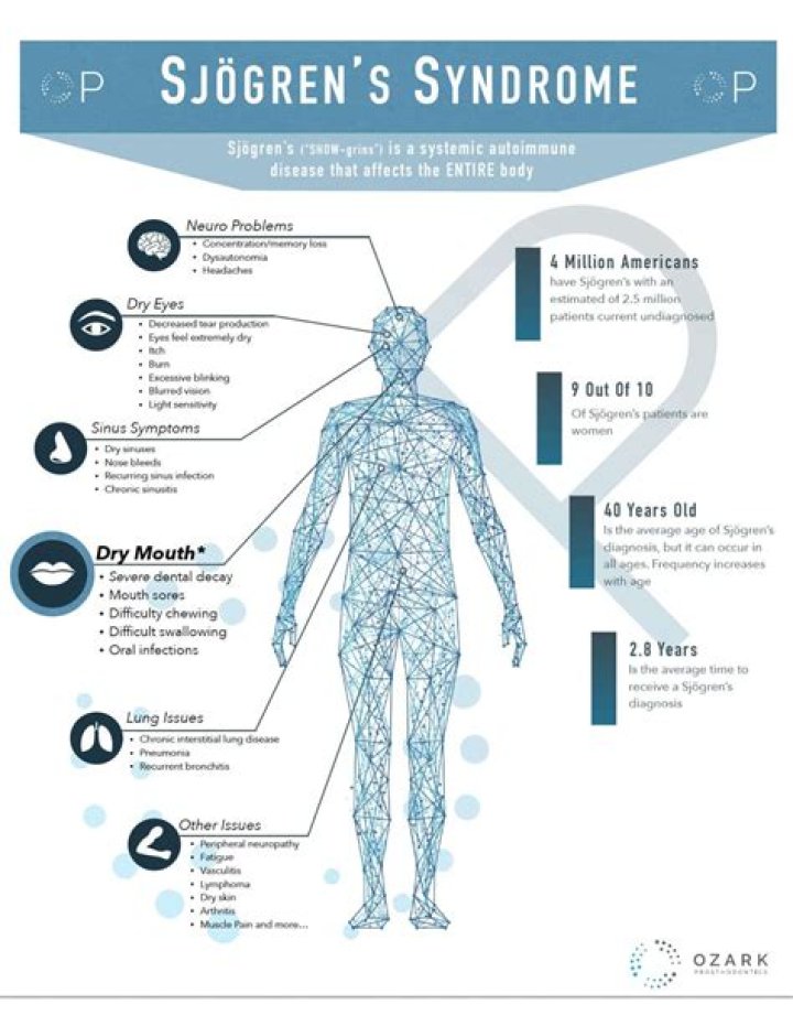 What are the hallmark symptoms of Sjogren's syndrome?