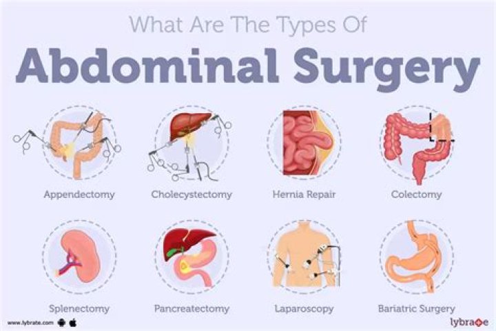 What are the minor surgeries?