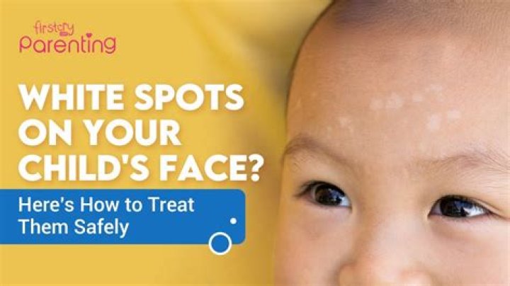 What are the white dots on a driver face?