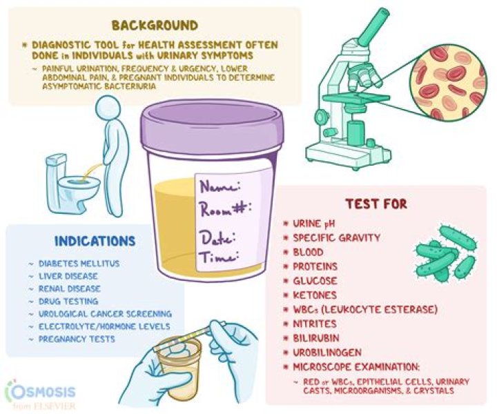 What blood test is done to check for PCOS?