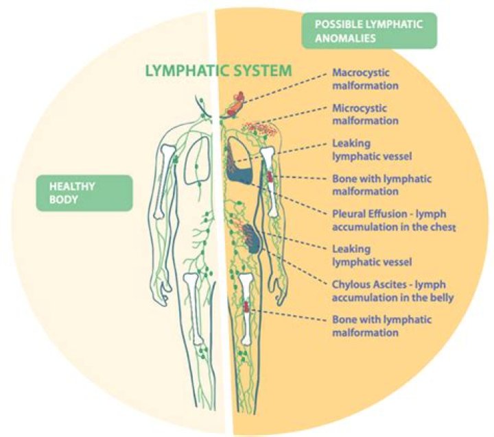 What can I drink to drain my lymphatic system?