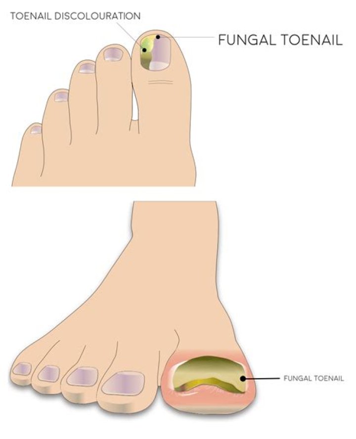 What causes toenails to not grow?