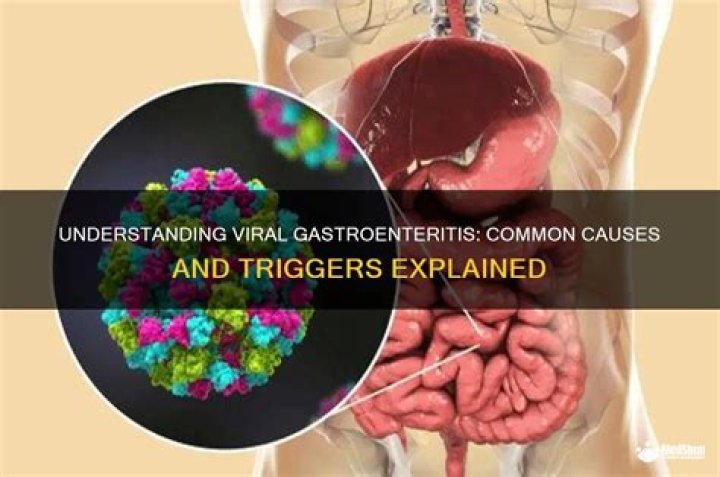 What causes viral gastroenteritis?