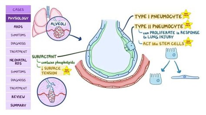 What causes wet lungs?