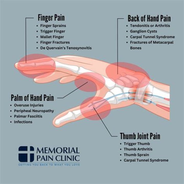 What does MS hand pain feel like?