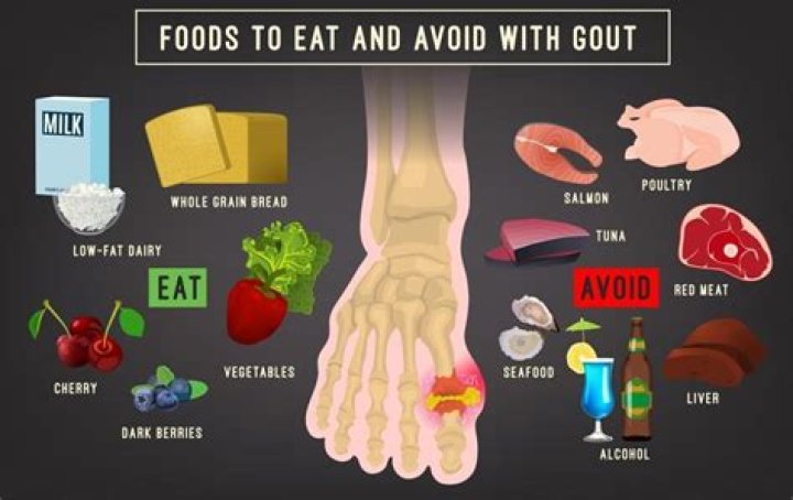 What drinks to avoid when you have gout?